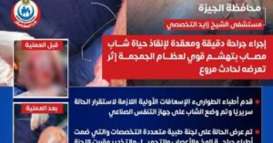 نجاح جراحة معقدة لشاب يعاني من تهشم بالجمجمة في مستشفى الشيخ زايد التخصصى عام 2025