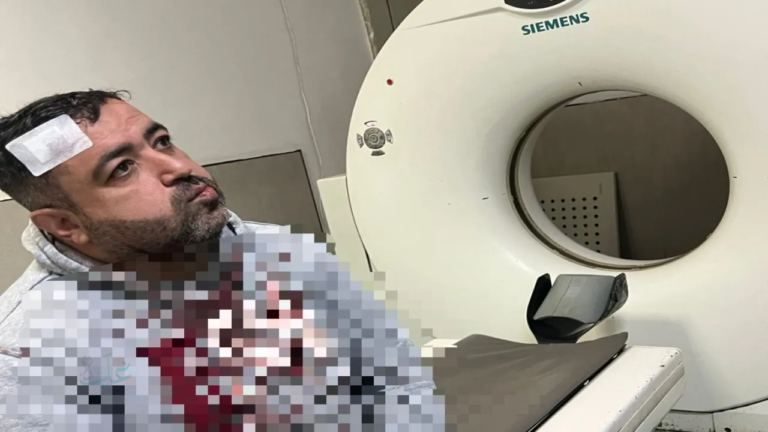 الصحفي التميمي يغادر المستشفى بعد تلقيه العلاج إثر الاعتداء عليه.. التفاصيل كاملة