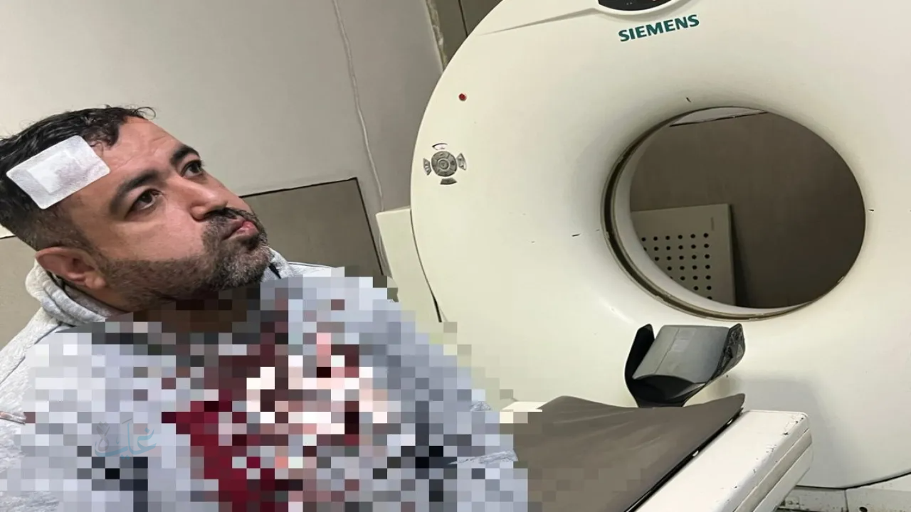 الصحفي التميمي يغادر المستشفى بعد تلقيه العلاج إثر الاعتداء عليه.. التفاصيل كاملة